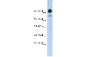 WB Suggested Anti-ABAT Antibody Titration: 0. (ABAT antibody  (Middle Region))