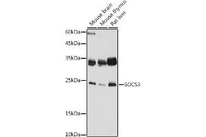 Western blot analysis of extracts of various cell lines, using SOCS3 antibody (ABIN3015316, ABIN3015317, ABIN5663764 and ABIN6213984) at 1:1000 dilution. (SOCS3 antibody  (C-Term))