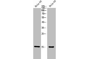 Western Blot analysis of Hela+UV 5' cells using Phospho-Histone H2A (T121) Polyclonal Antibody. (HIST1H2AG/HIST1H2AB/HIST1H2AD/HIST1H2AH/HIST2H2AA3/HIST3H2A (pThr121) antibody)
