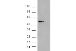 Image no. 2 for anti-V-Akt Murine Thymoma Viral Oncogene Homolog 3 (Protein Kinase B, Gamma) (AKT3) (Internal Region) antibody (ABIN374493) (AKT3 antibody  (Internal Region))