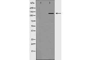 Western blot analysis of Collagen III expression in HT1080 Whole cell lysate. (COL3A1 antibody  (N-Term))
