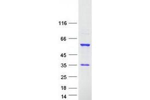 Western Blotting (WB) image for RNA Binding Motif Protein 23 (RBM23) (Transcript Variant 2) protein (Myc-DYKDDDDK Tag) (ABIN2730610)