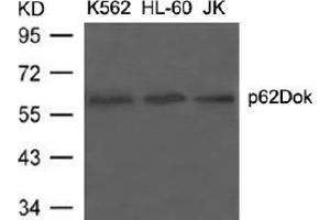 Image no. 3 for anti-Docking Protein 1, 62kDa (Downstream of tyrosine Kinase 1) (DOK1) (Tyr398) antibody (ABIN197539) (DOK1 antibody  (Tyr398))