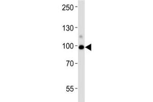 Western blot analysis of lysate from human kidney tissue lysate using ACE2 antibody diluted at 1:1000.