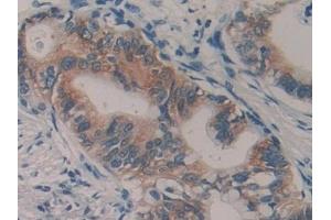 Immunohistochemistry (IHC) image for anti-Transmembrane Protease, serine 4 (TMPRSS4) (AA 54-437) antibody (ABIN7436138)