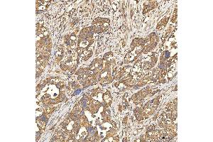 IHC analysis of Citrin/SLC25A13 using anti-Citrin/SLC25A13 antibody (ABIN7599512). (slc25a13 antibody  (AA 1-643))