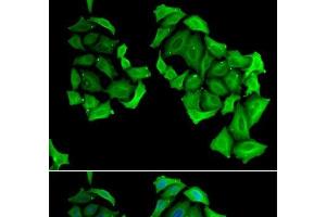 Immunofluorescence analysis of HeLa cells using C4BPB Polyclonal Antibody (C4BPB antibody)