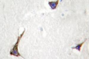 Image no. 2 for anti-Syndecan 4 (SDC4) antibody (ABIN317791) (SDC4 antibody)