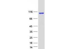 Validation with Western Blot