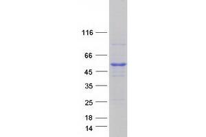 Validation with Western Blot (GTR2 Protein (Myc-DYKDDDDK Tag))