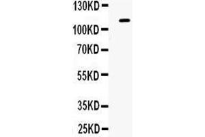 Observed bind size: 111KD (EPH Receptor B1 antibody  (N-Term))