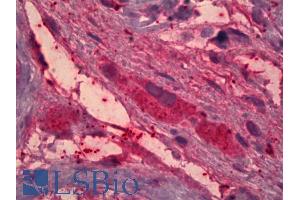 ABIN768658 (5µg/ml) staining of paraffin embedded Human Testis. (ITIH4 antibody  (AA 890-903))
