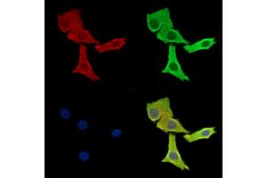 ABIN7095945 and ABIN7100007 staining Hela cells by IF/ICC. (RASGRP4 antibody)