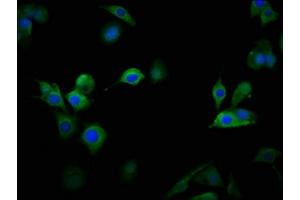 Immunofluorescence staining of MCF-7 cells with ABIN7175590 at 1:100, counter-stained with DAPI. (CACNA1D antibody  (AA 1691-1806))