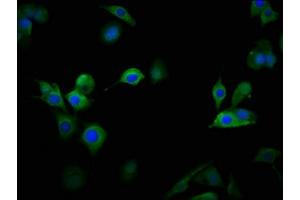 Immunofluorescence (IF) image for anti-Calcium Channel, Voltage-Dependent, L Type, alpha 1D Subunit (CACNA1D) (AA 1691-1806) antibody (ABIN7175590)