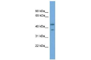 WB Suggested Anti-PRPSAP2 Antibody Titration: 0. (PRPSAP2 antibody  (Middle Region))