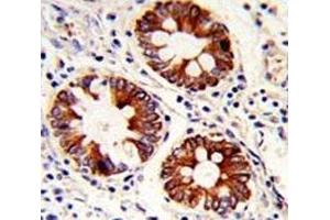 Immunohistochemistry (IHC) image for anti-Keratin 18 (KRT18) (AA 401-430) antibody (ABIN3031537)