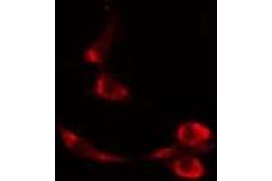 ABIN6277088 staining  Hela cells by IF/ICC. (Progesterone Receptor antibody  (Internal Region))