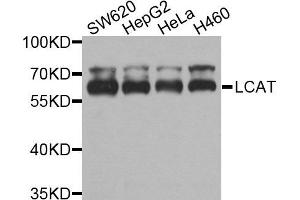 Western blot analysis of extracts of various cells, using LCAT antibody. (LCAT antibody)