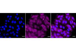 Immunocytochemical staining of HepG2 cells with caspase 8 antibody (ABIN7797907), 1:1,000). (Recombinant Caspase 8 antibody)