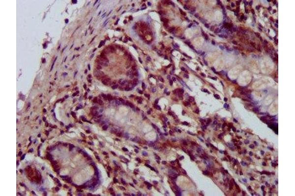 SHPRH antibody  (AA 1362-1512)