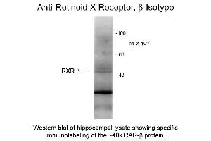Western blot of Anti-Retinoid X Receptor beta (Mouse) Antibody - 200-301-E27 Western Blot of Mouse anti-Retinoid X Receptor beta antibody. (Retinoid X Receptor beta antibody)