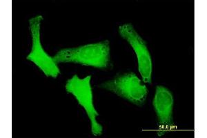 Immunofluorescence of purified MaxPab antibody to RANBP5 on HeLa cell. (Importin 5 antibody  (AA 1-1115))