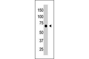 The CRY1 polyclonal antibody  is used in Western blot to detect CRY1 in placenta tissue lysate. (CRY1 antibody  (C-Term))