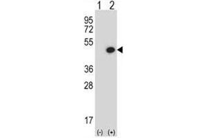 Western blot analysis of BMP7 antibody and 293 cell lysate either nontransfected (Lane 1) or transiently transfected (2) with the BMP7 gene. (BMP7 antibody  (AA 280-309))