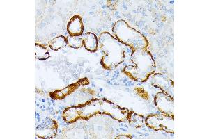 Immunohistochemistry of paraffin-embedded mouse kidney using IL3RA antibody (ABIN1680453, ABIN3018298, ABIN3018299, ABIN5664529 and ABIN6220429) at dilution of 1:100 (40x lens). (IL3RA antibody  (AA 1-100))