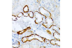 Immunohistochemistry of paraffin-embedded mouse kidney using IL3RA antibody (ABIN1680453, ABIN3018298, ABIN3018299, ABIN5664529 and ABIN6220429) at dilution of 1:100 (40x lens). (IL3RA antibody  (AA 1-100))