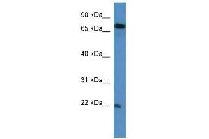 Western Blot showing SFT2D3 antibody used at a concentration of 1-2 ug/ml to detect its target protein. (SFT2D3 antibody  (N-Term))