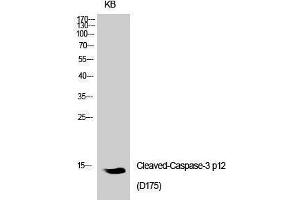Western Blotting (WB) image for anti-Caspase 3 p12 (Asp175), (cleaved) antibody (ABIN3172729) (Caspase 3 p12 (Asp175), (cleaved) antibody)