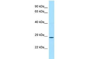 WB Suggested Anti-Cfdp1 Antibody Titration: 1. (CFDP1 antibody  (C-Term))