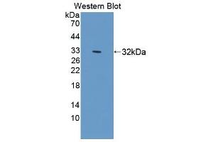 Detection of Recombinant SIRPa, Mouse using Polyclonal Antibody to Signal Regulatory Protein Alpha (SIRPa)