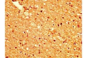 IHC image of ABIN7164465 diluted at 1:500 and staining in paraffin-embedded human brain tissue performed on a Leica BondTM system. (GPR158 antibody  (AA 882-1003))