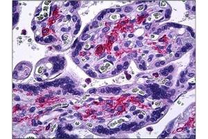 Human Placenta: Formalin-Fixed, Paraffin-Embedded (FFPE) (MMP11 antibody  (Internal Region))