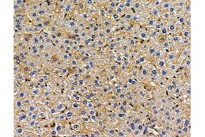 ABIN7096974 and ABIN7101041 at 1/100 staining mouse liver tissue by IHC-P. (CYB5D2 antibody)