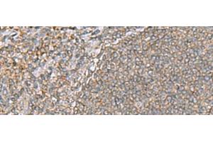 Immunohistochemistry of paraffin-embedded Human tonsil tissue using ARF5 Polyclonal Antibody at dilution of 1:55(x200) (ARF5 antibody)
