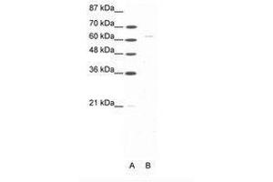 Image no. 1 for anti-Forkhead Box N1 (FOXN1) (AA 51-100) antibody (ABIN202851) (FOXN1 antibody  (AA 51-100))