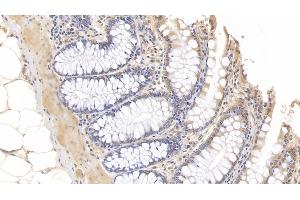 Detection of IL10 in Porcine Colon Tissue using Monoclonal Antibody to Interleukin 10 (IL10) (IL-10 antibody  (AA 19-175))
