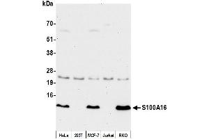 anti-S100 Calcium Binding Protein A16 (S100A16) (AA 53-103) antibody