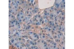 Figure. (Dystrobrevin beta antibody  (AA 1-249))