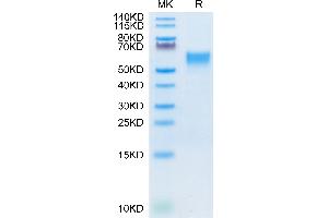 IL3RA Protein (AA 18-302) (His tag)