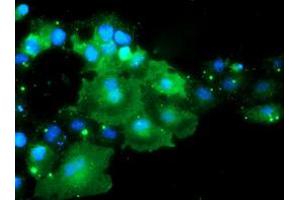 Anti-DOK7 mouse monoclonal antibody (ABIN2455821) immunofluorescent staining of COS7 cells transiently transfected by pCMV6-ENTRY DOK7 (RC219267). (DOK7 antibody)