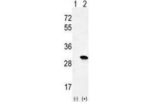 Western blot analysis of H-RAS antibody and 293 cell lysate either nontransfected (Lane 1) or transiently transfected (2) with the HRAS gene. (HRAS antibody  (AA 146-176))