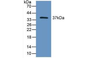 Western blot analysis of recombinant Mouse HIF2a.