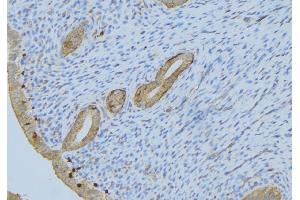 ABIN6275548 at 1/100 staining Human uterus tissue by IHC-P. (PPP2R1B antibody  (C-Term))