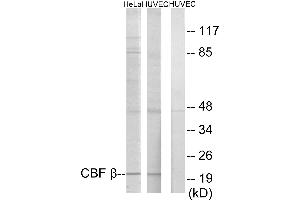 Immunohistochemistry analysis of paraffin-embedded human heart tissue using CBF β antibody. (CBFB antibody)