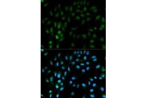 Immunofluorescence analysis of MCF-7 cells using TFPI antibody. (TFPI antibody  (AA 29-224))